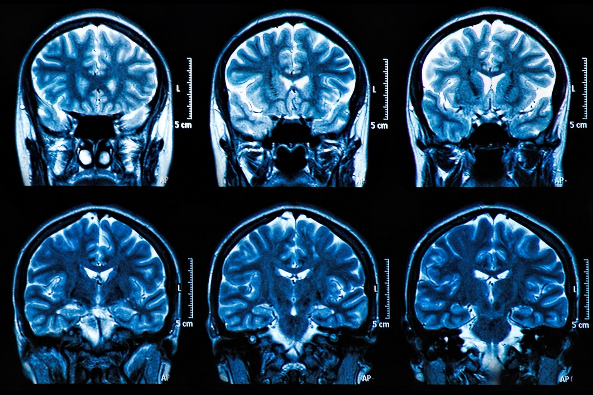 MRI Brain Scan Neuroscience Images