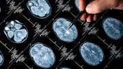 MRI Brain Scan Pen Pointing
