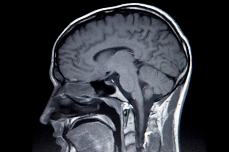 MRI Brain Scan Profile