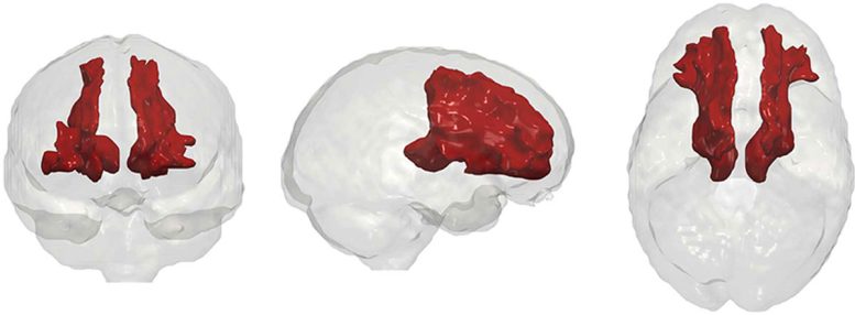 MRI Scans One Month After Psilocybin