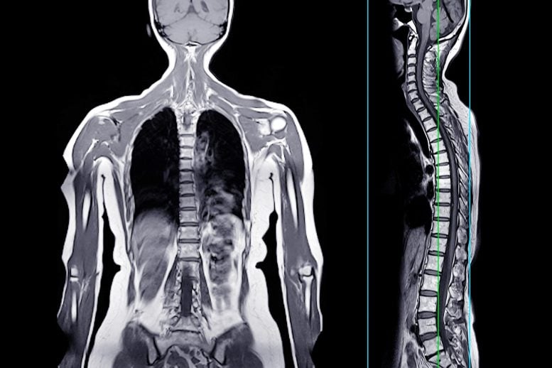 A Healthy 47-Year-Old Ate a Hamburger. Hours Later, He Was Dead