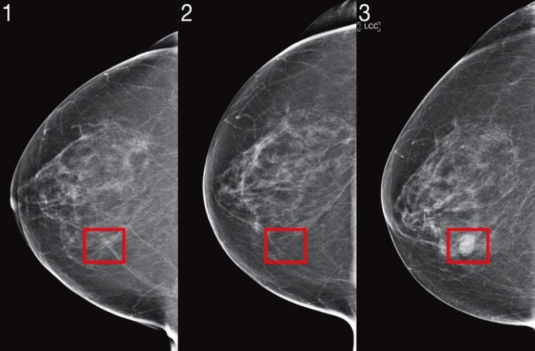Machine Learning Predict Cancer Risk From Mammogram Images