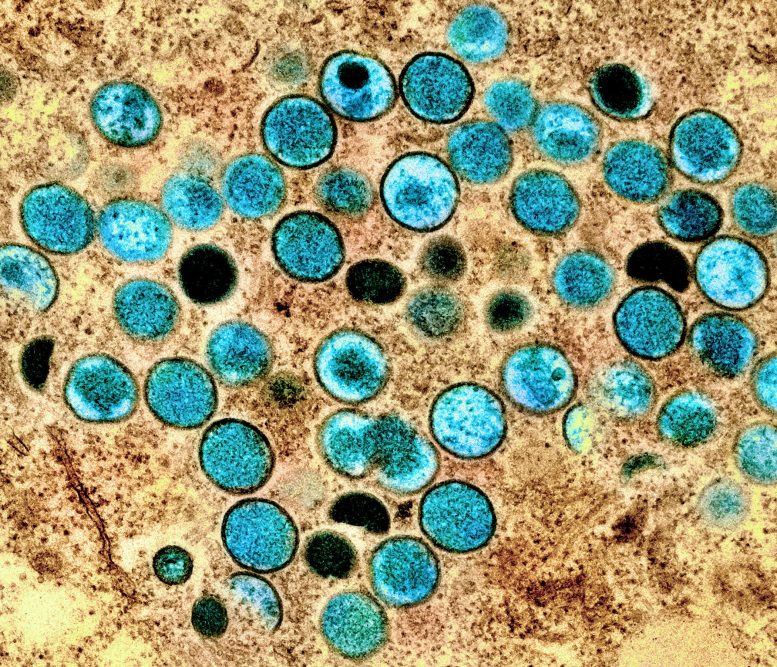 Magnified and Colorized Monkeypox Virus Particles