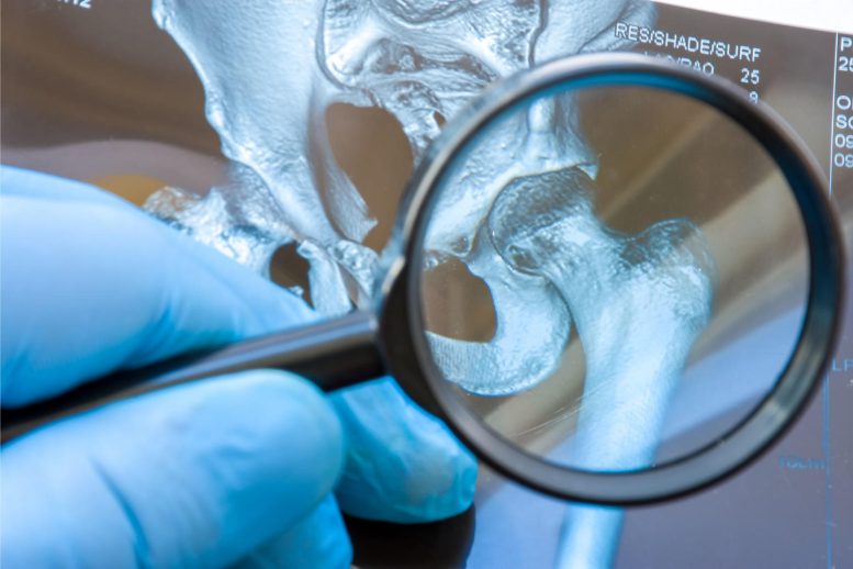 Magnifying Glass Bone Hip