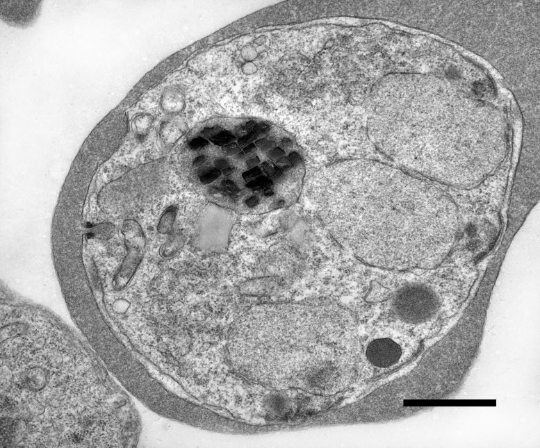 Malaria Parasite Inside a Human Red Blood Cell