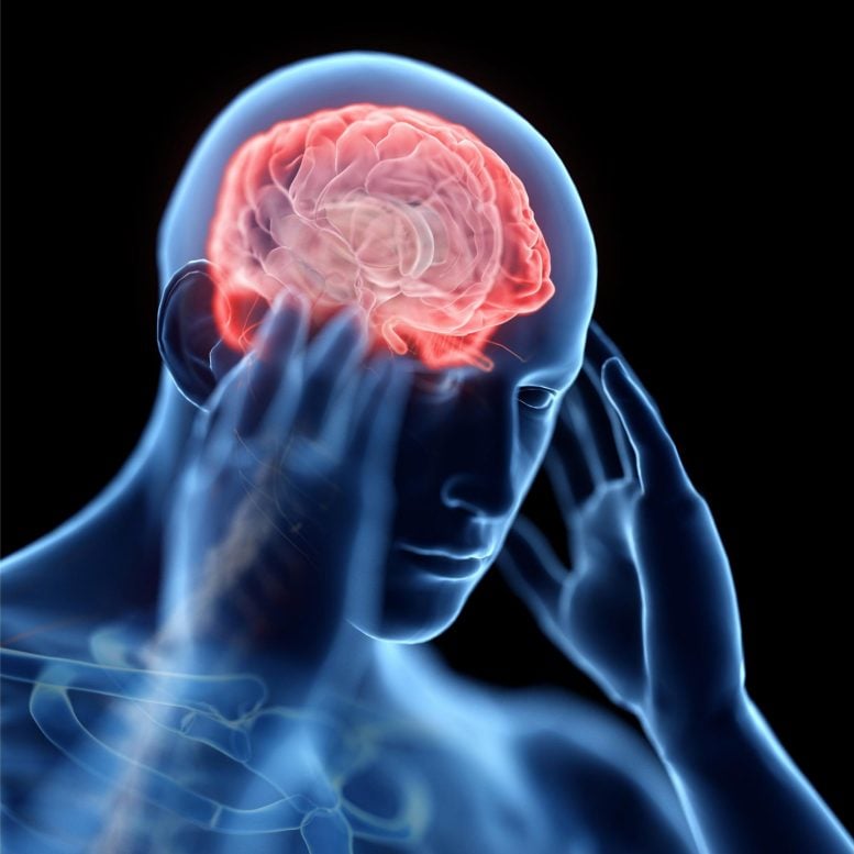 Man Headache Anatomy Science Image