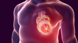 Man Heart Attack Cardiology Illustration