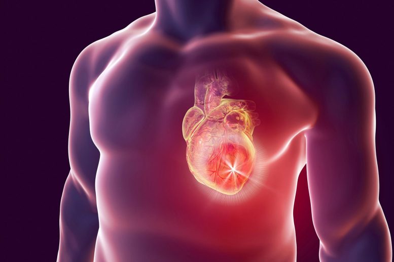 Man Heart Attack Cardiology Illustration
