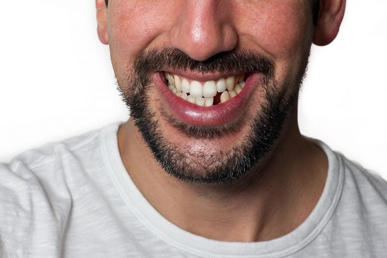 Man Missing Tooth