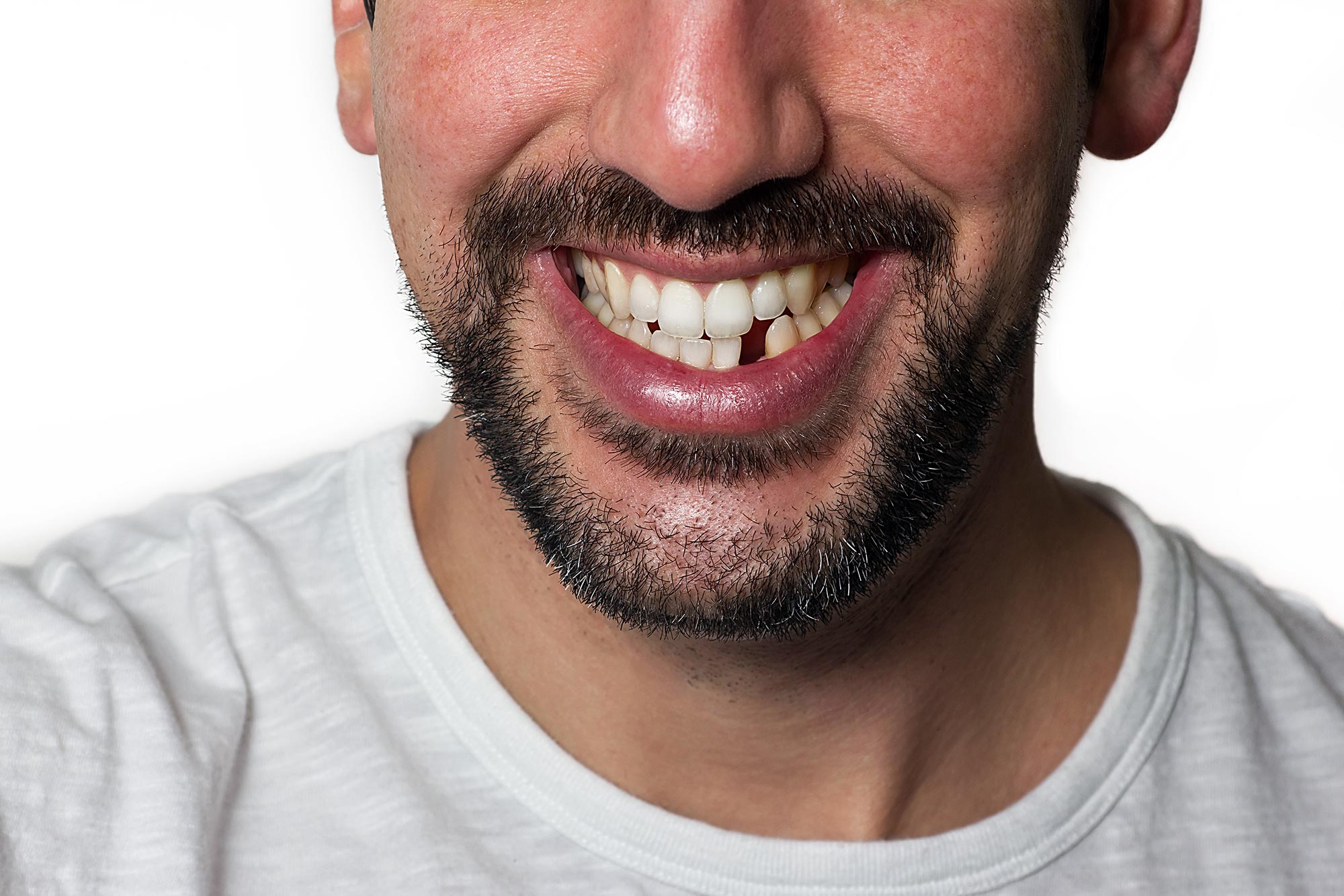 Сонник выпадение зубов без. Улыбка мужская. Красивая челюсть. Зубы человека.