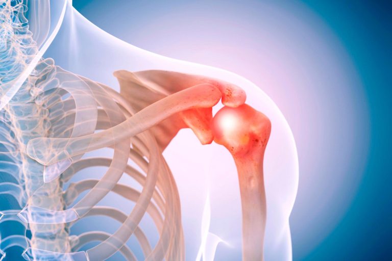 Python Power: New Bio-Inspired Device Doubles Strength of Rotator Cuff ...