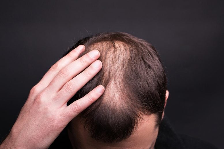 Man Touching Balding Head