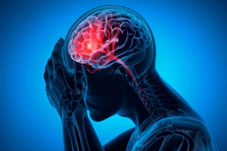 Man With Headache Brain Bleed Stroke