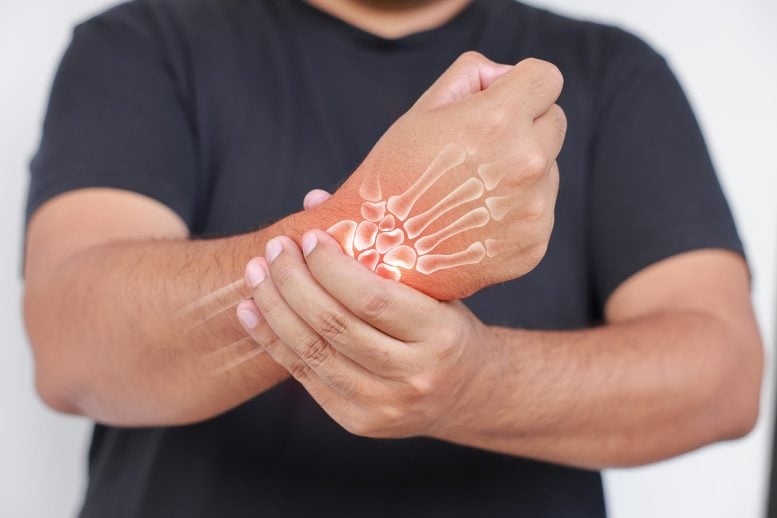 Man Wrist Bones Joints Pain Arthritis