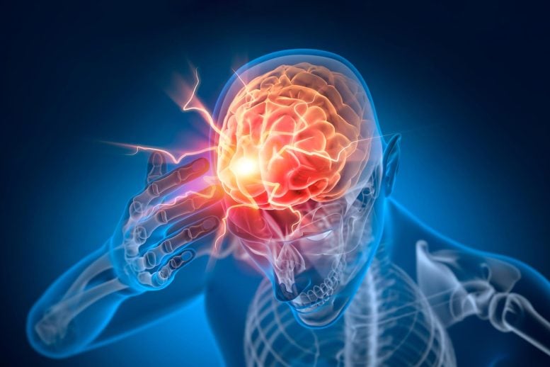 Man X Ray Headache Brain Stroke Electricity Shock Pain
