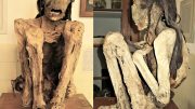 Marburg Male Mummy