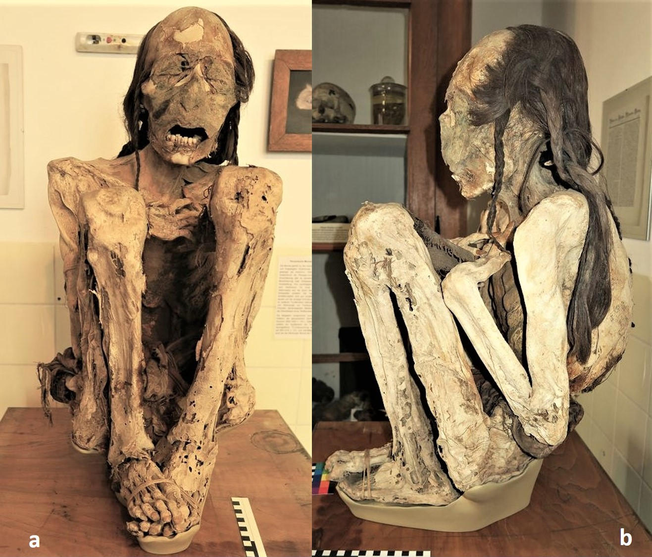 Marburg Male Mummy