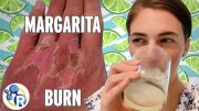 Margarita Burn