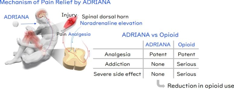 Mechanism of Pain Relief by ADRIANA