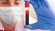 Medical Blood Test Tubes