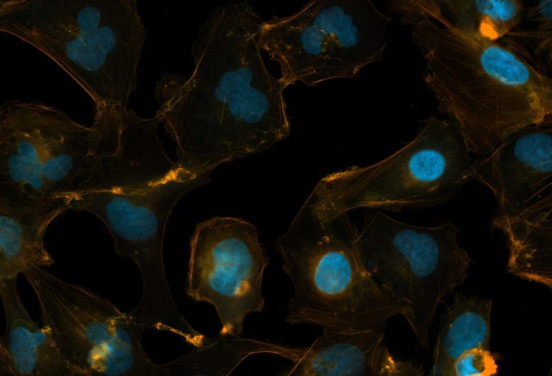 Medulloblastoma Cells Kept in 3D Culture