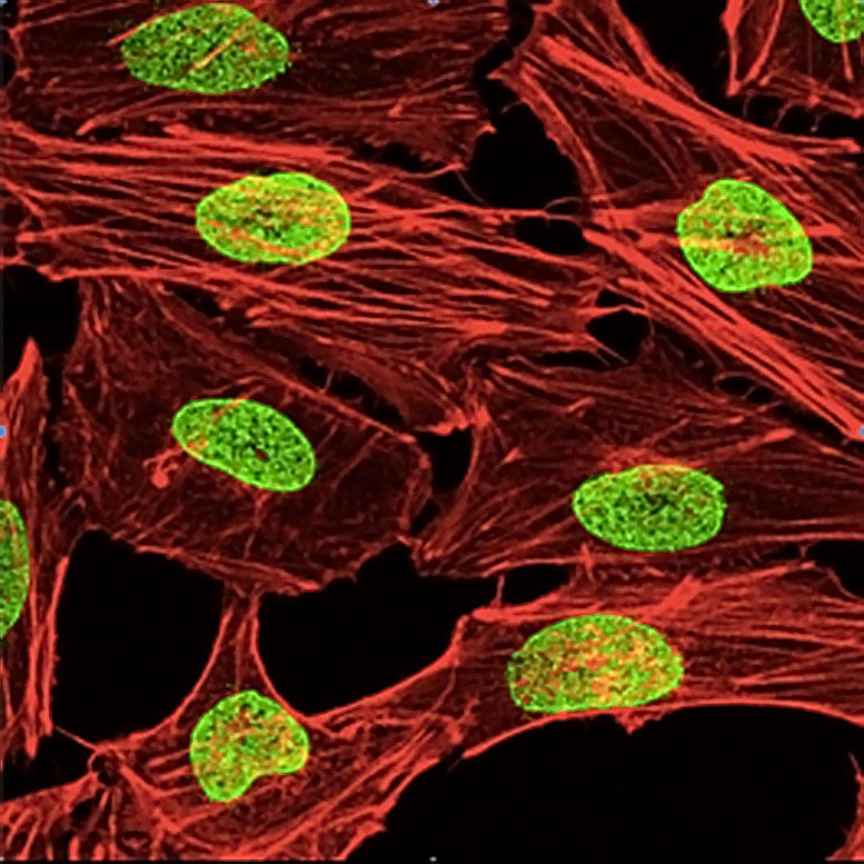 Melanoma Cells Nuclear Pores