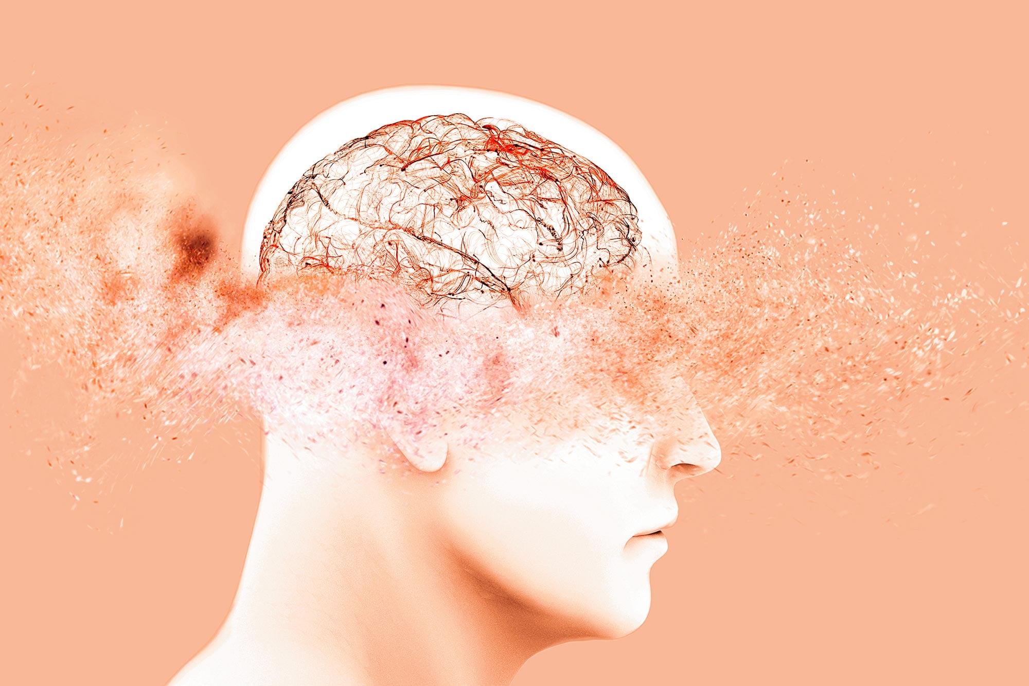 Nicht nur Alzheimer: Wissenschaftler entdecken Hinweise auf eine zweite, übersehene Erkrankung