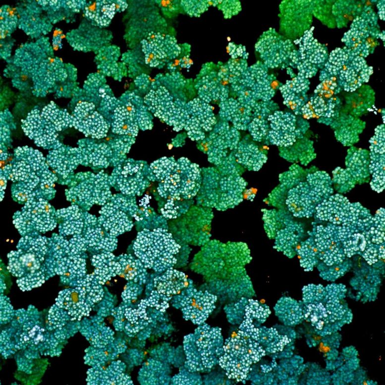 Microscopia del biofilm microbico