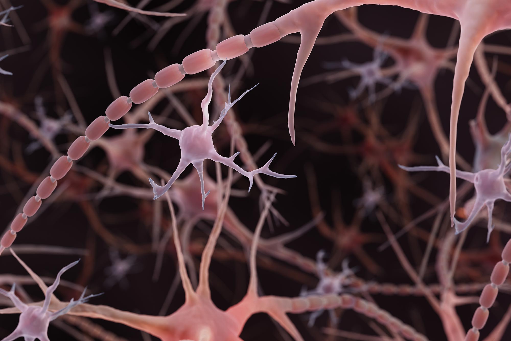 Some Brains Stay Sharp Thanks to a Plaque Eating Immune Cell That Fights Alzheimer’s - SciTechDaily