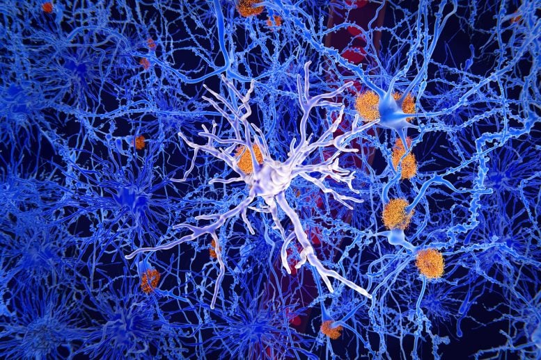 Microglia Cell Brain Neuroscience Alzheimer’s Disease