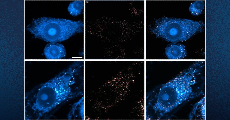 Microglia Containing Lipid Droplets
