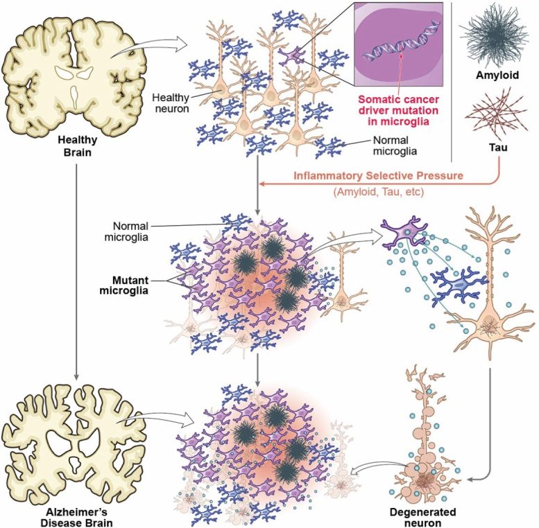 Microglia Like Immune Cells With Cancer Mutations Emerge in the Brain