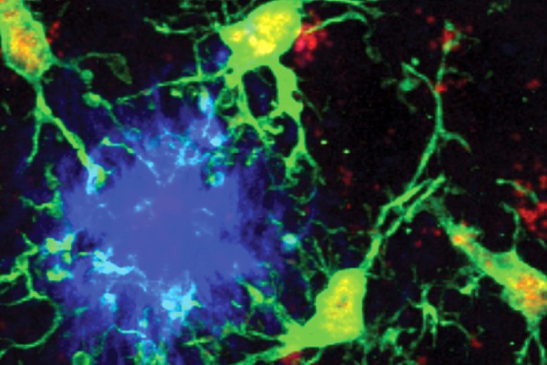Microglia Responding to Aggregated Beta Amyloid Plaques