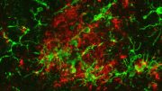 Microglia and Beta Amyloid