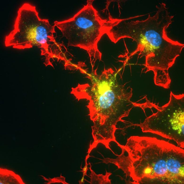 Microglial Cells