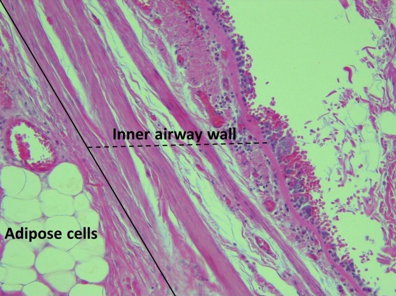 Micrographs Adipose Tissue Lungs Asthma