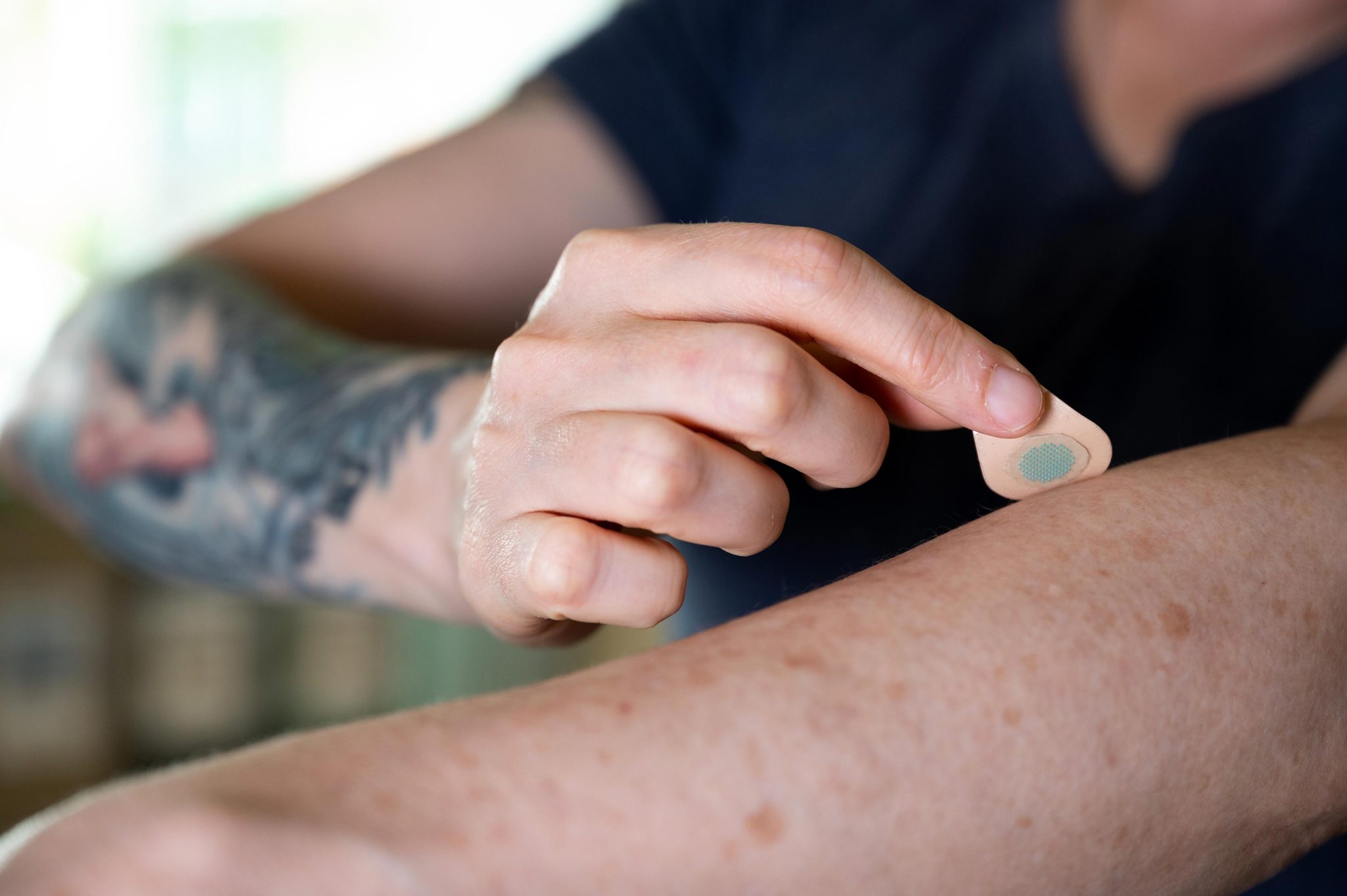 Microneedle Patch Tattoo Being Applied
