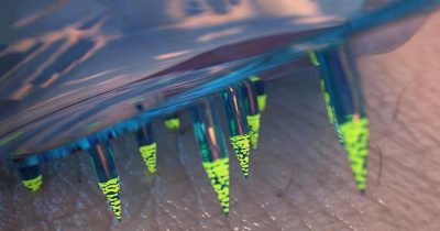 Microneedle Patches