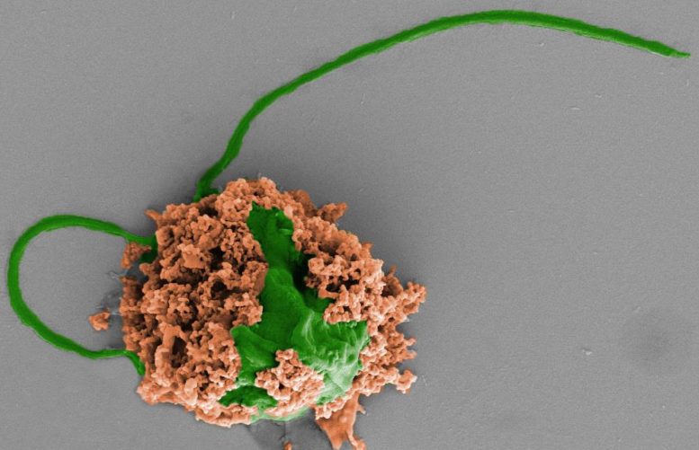 Microrobots Treat Deadly Pneumonia in Mice