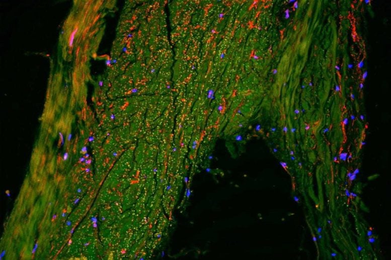 Microscope Image Showing Lymphatic Vessels in Red