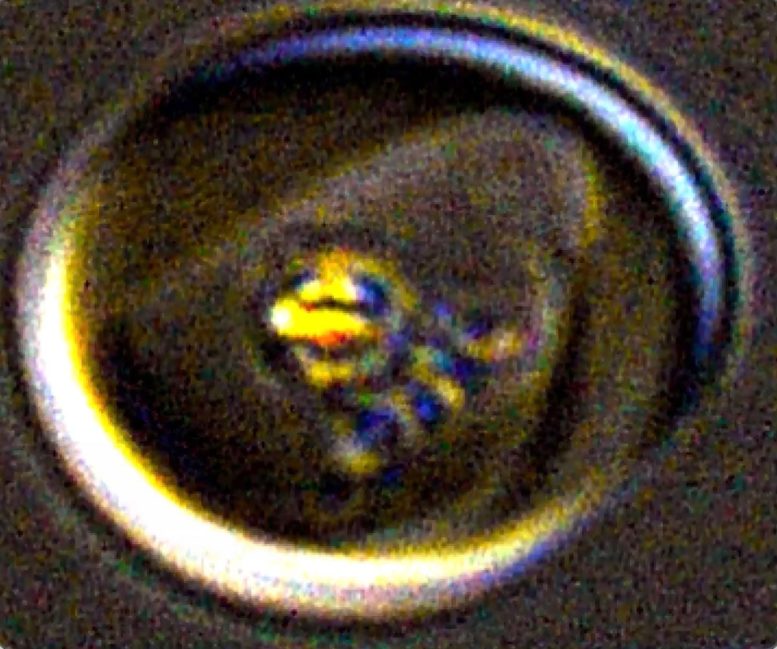 Microscope Image of a Live Malaria Parasite