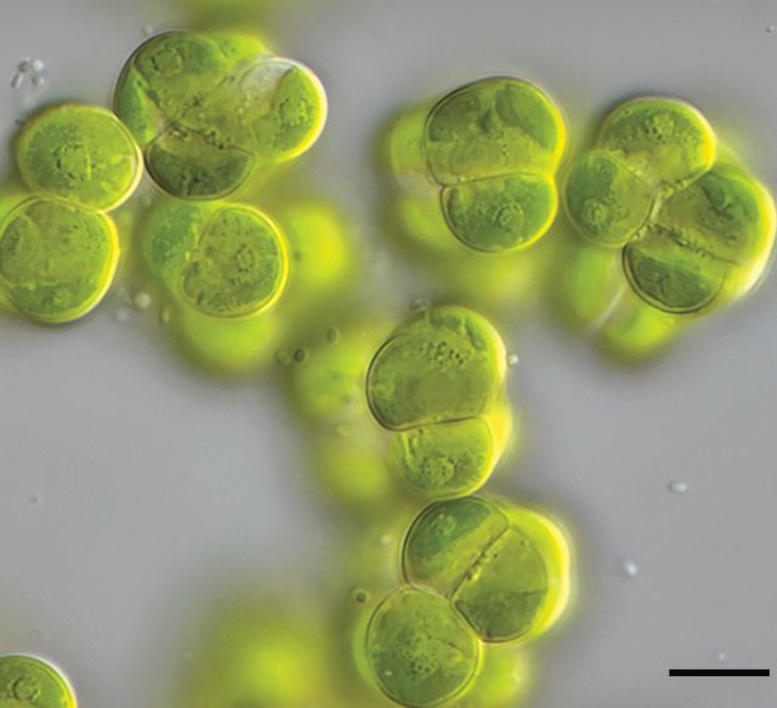 Microscope Image of the Multicellular Alga Streptosarcina arenaria