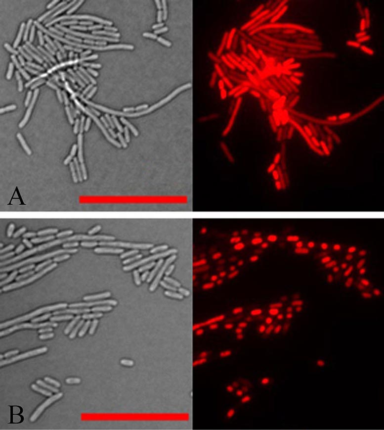 Microscope Images of E. coli Exposed to Antibacterial Protein