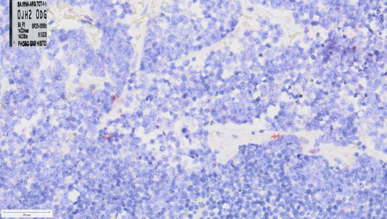 Microscopic View of Low TRNA