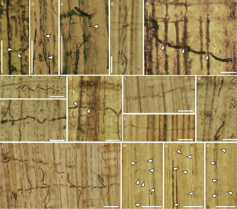Microscopic Views of Jurassic Blue Stain Fungal Hyphae
