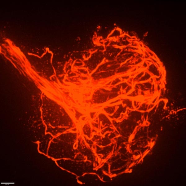 Microtubules Within Broken Neural Axon