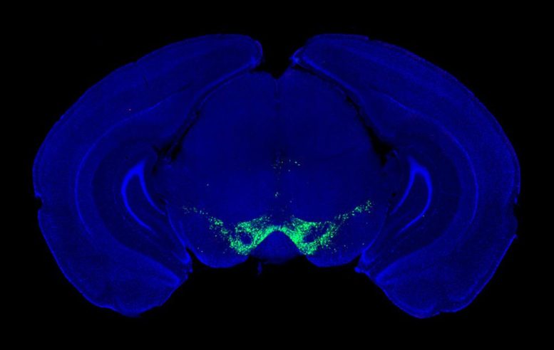 Midbrain Dopamine Producing Neurons