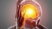 Migraine Headache Brain Illustration