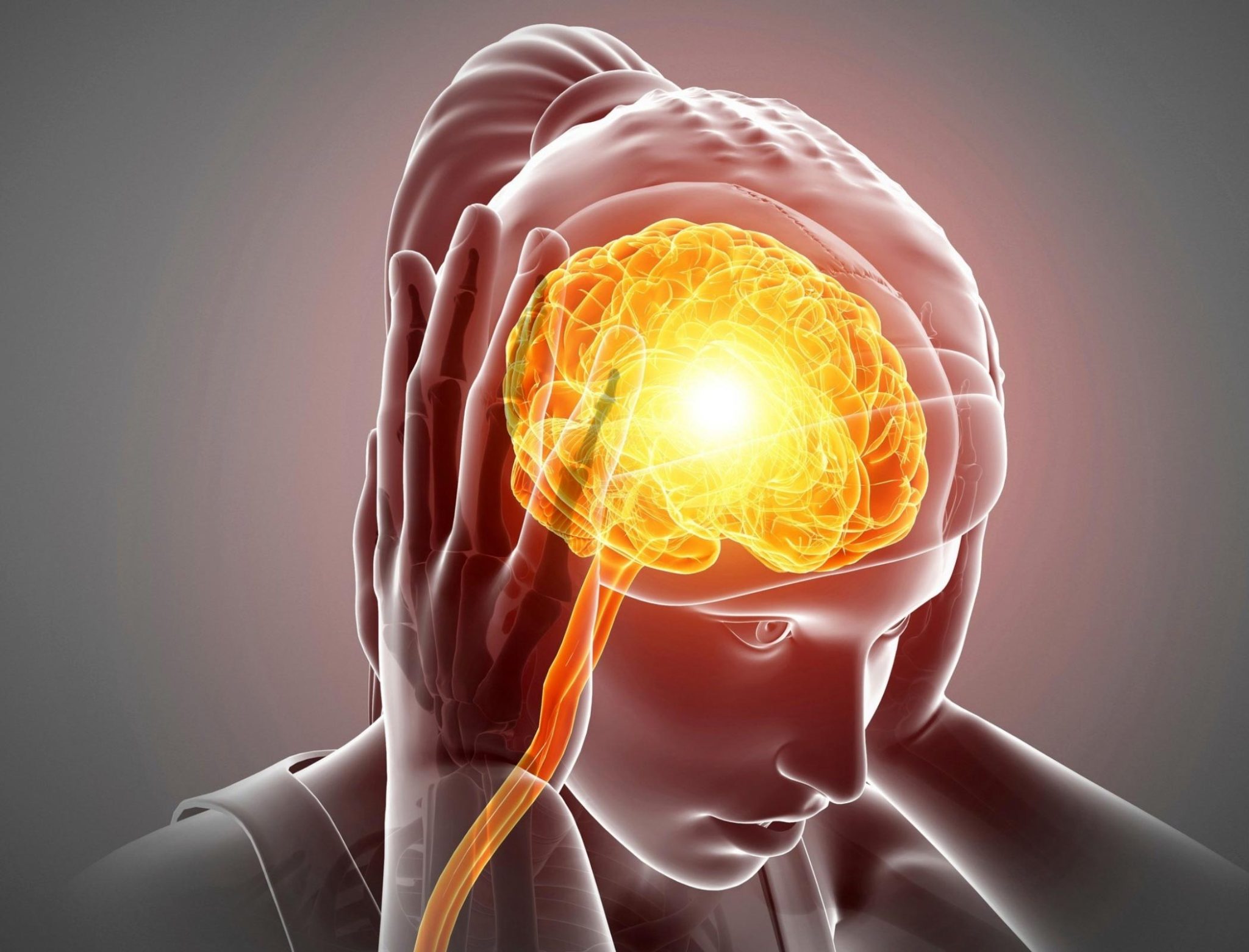 Migraine Headache Brain Illustration