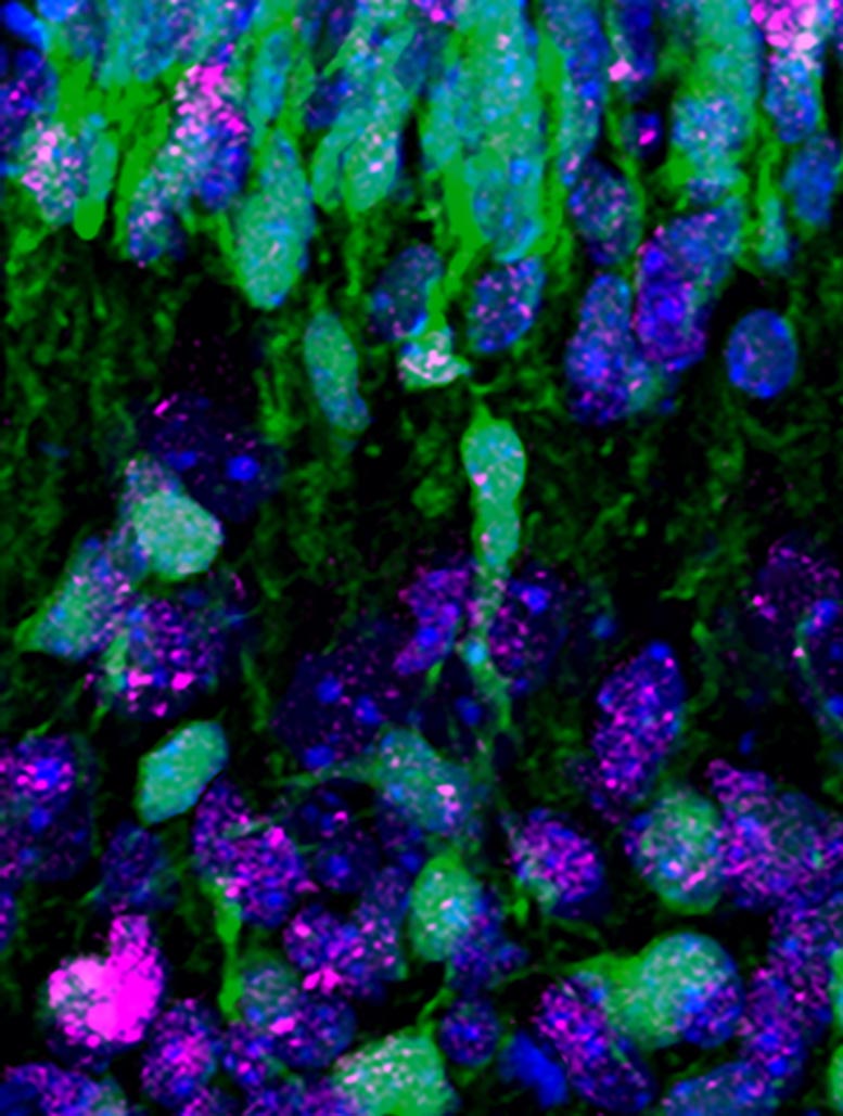 Migrating Neurons DNA Damage